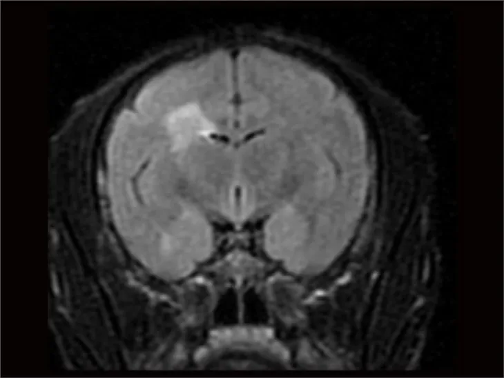 التصلب المتعدد نموذج مرض الرئيسيات غير البشرية