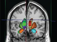 تقنية التوصيل المعزز بالحمل الحراري (CED).