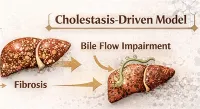 نموذج تليف الكبد